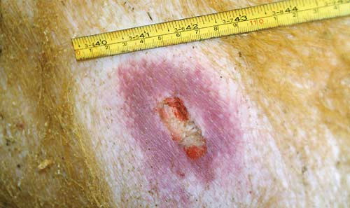 Рвано-ушибленная рана кожи. Пуля попала между рёбер животного и вызвала ушиб лёгкого